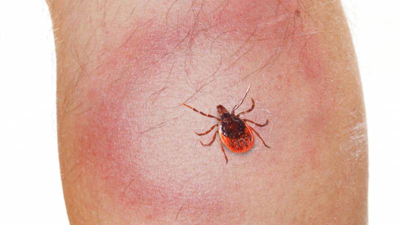 Symptoms of Tickborne Disease