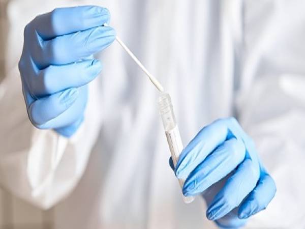 STI Testing