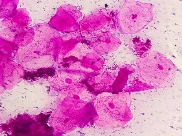 bacteria under microscope
