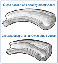 blood vessels