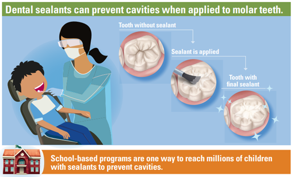 prevent cavities