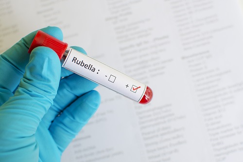 Rubella