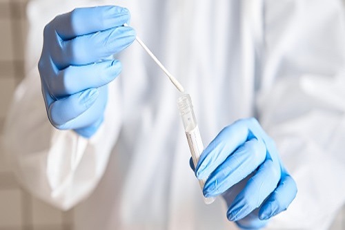 STI Testing