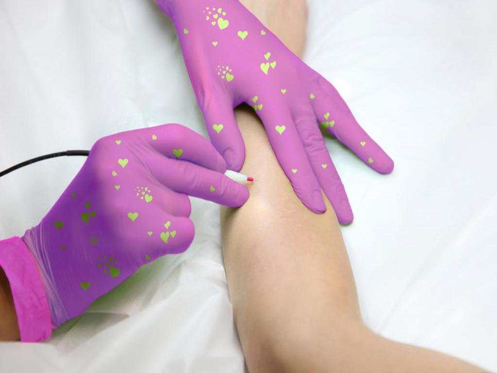 Hands with pink gloves doing electrology