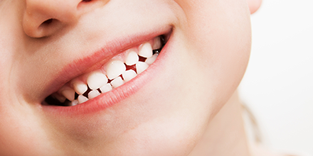 Child smiling showing teeth