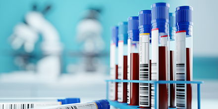 blood vials in a lab